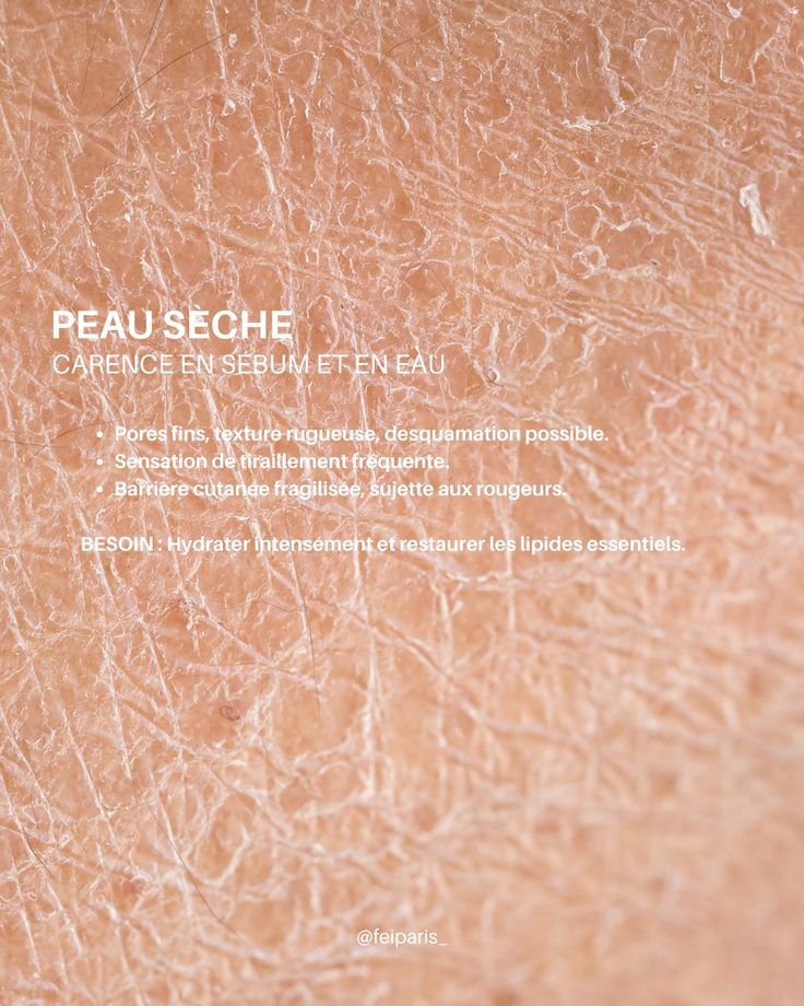 Peau sèche