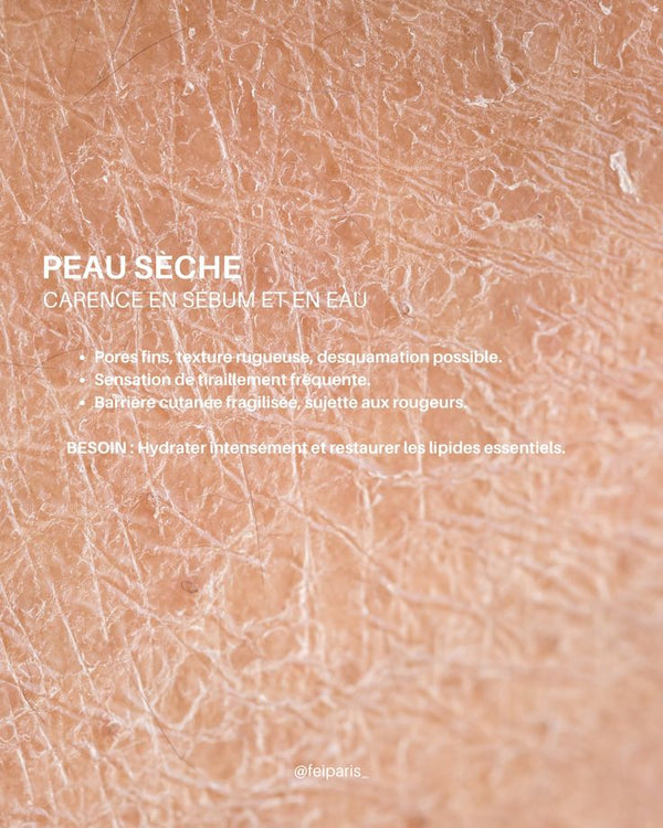 Peau sèche